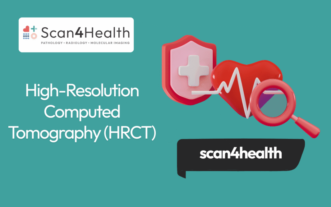 HRCT