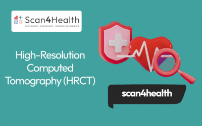 High-Resolution Computed Tomography (HRCT)