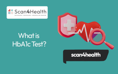 What is HbA1c Test?
