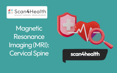 Magnetic Resonance Imaging (MRI): Cervical Spine