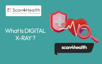 What Is DIGITAL X-RAY ?