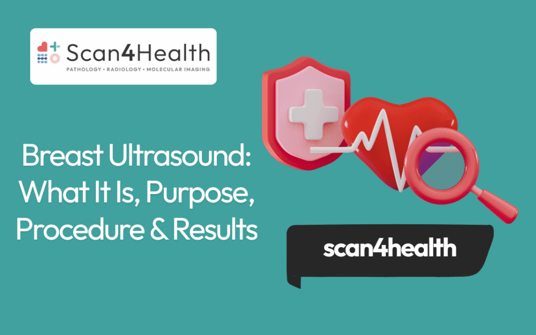 Breast Ultrasound: What It Is, Purpose, Procedure & Results