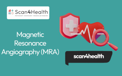 Magnetic Resonance Angiography (MRA)