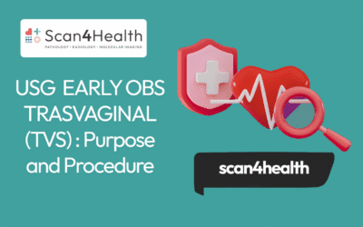 USG EARLY OBS TRASVAGINAL (TVS) : Purpose and Procedure