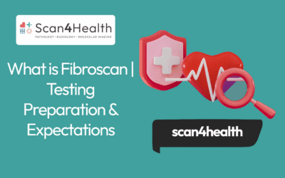 What is Fibroscan | Testing Preparation & Expectations