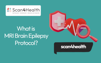 What is MRI Brain Epilepsy Protocol?