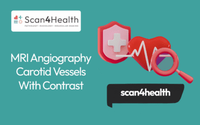 MRI Angiography Carotid Vessels With Contrast
