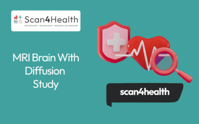 MRI Brain With Diffusion Study