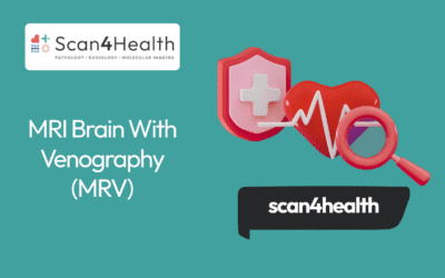 MRI Brain With Venography