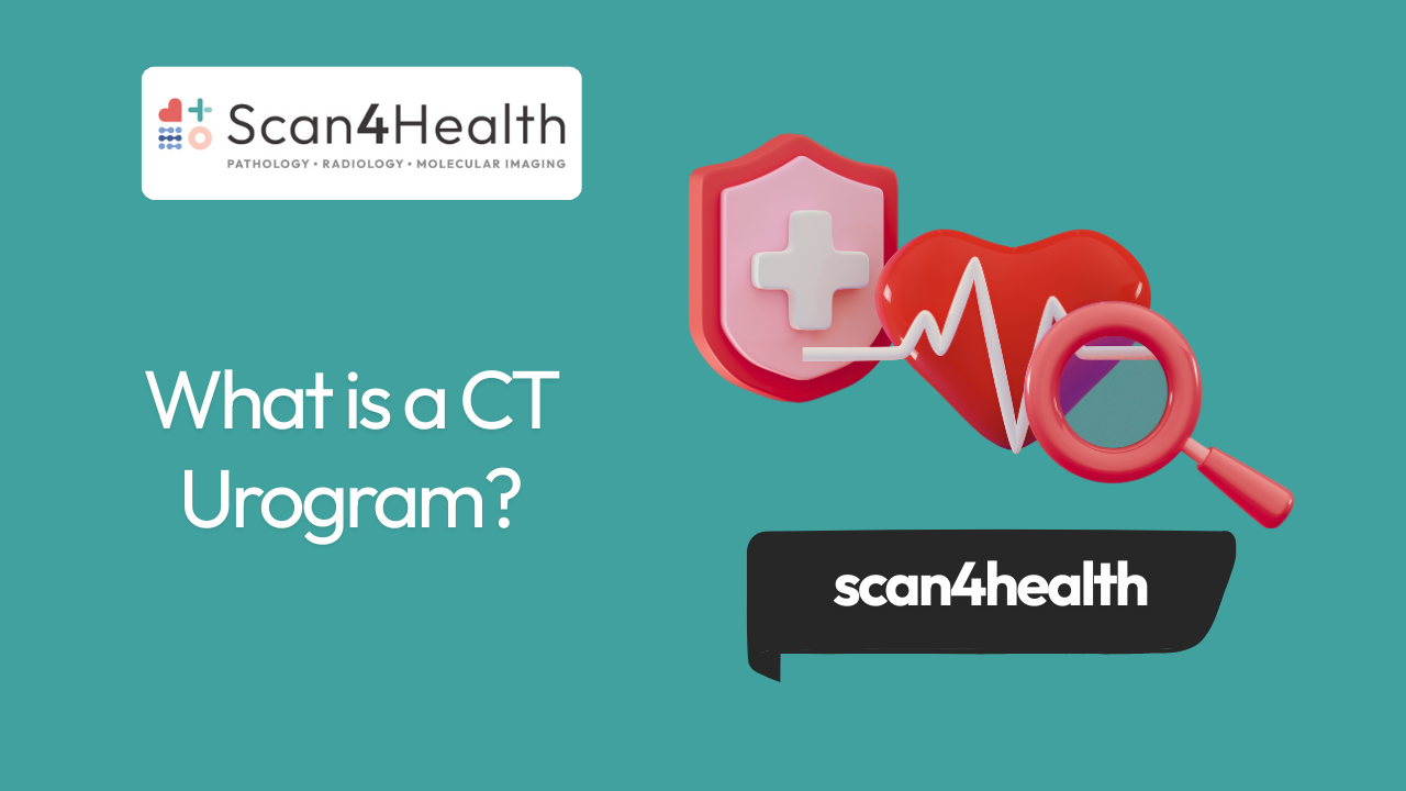 What is a CT Urogram? Procedure, Uses, Risks, and Results - Scan4Health ...