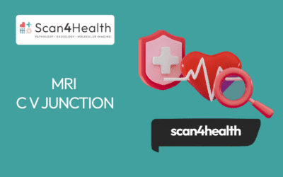 MRI C V JUNCTION