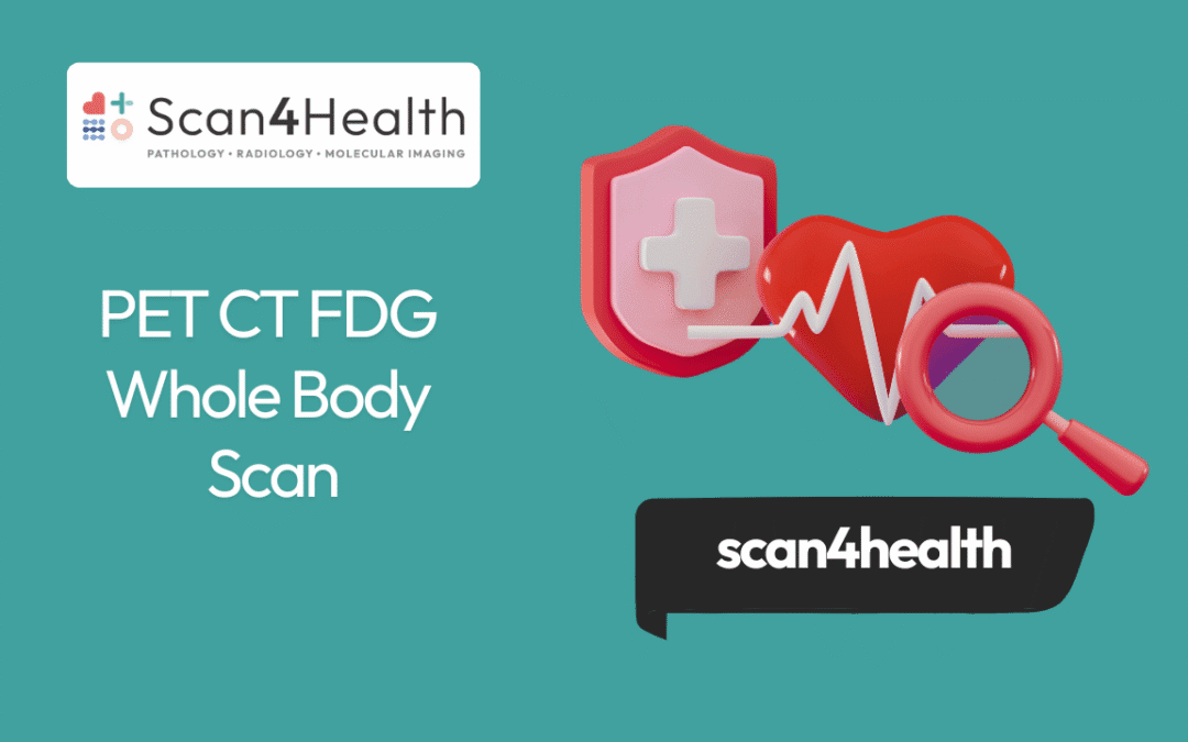 PET CT FDG Whole Body Scan.