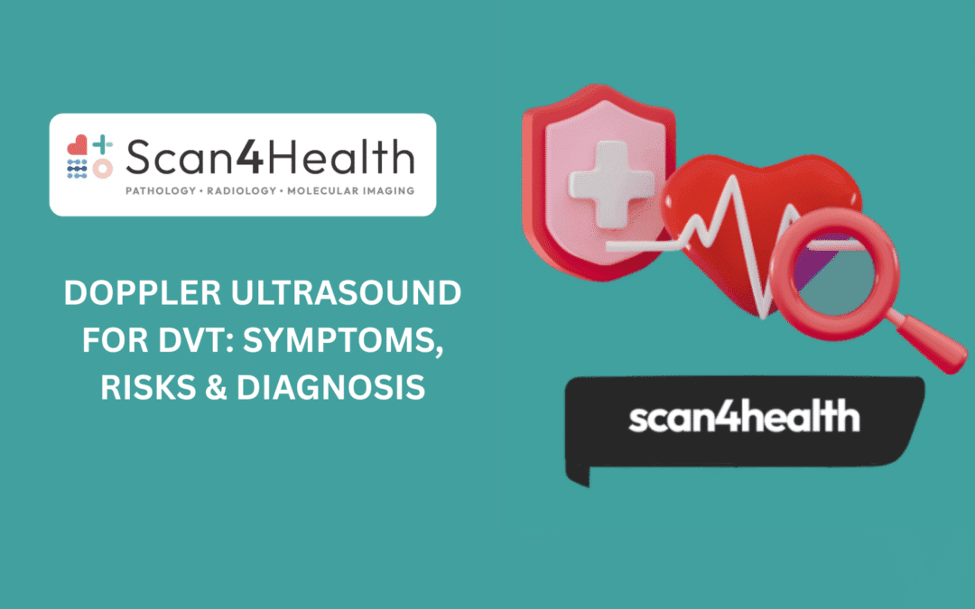 Doppler Ultrasound for DVT: Symptoms, Risks & Diagnosis