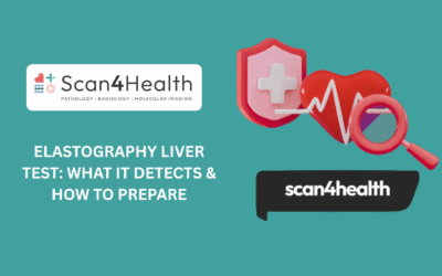Elastography Liver Test: What It Detects & How to Prepare