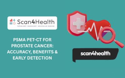 PSMA PET-CT for Prostate Cancer: Accuracy, Benefits & Early Detection