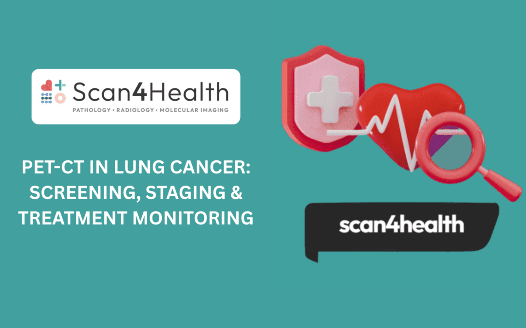 PET-CT in Lung Cancer: Screening, Staging & Treatment Monitoring