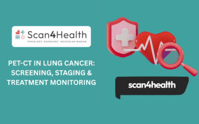 PET-CT in Lung Cancer: Screening, Staging & Treatment Monitoring